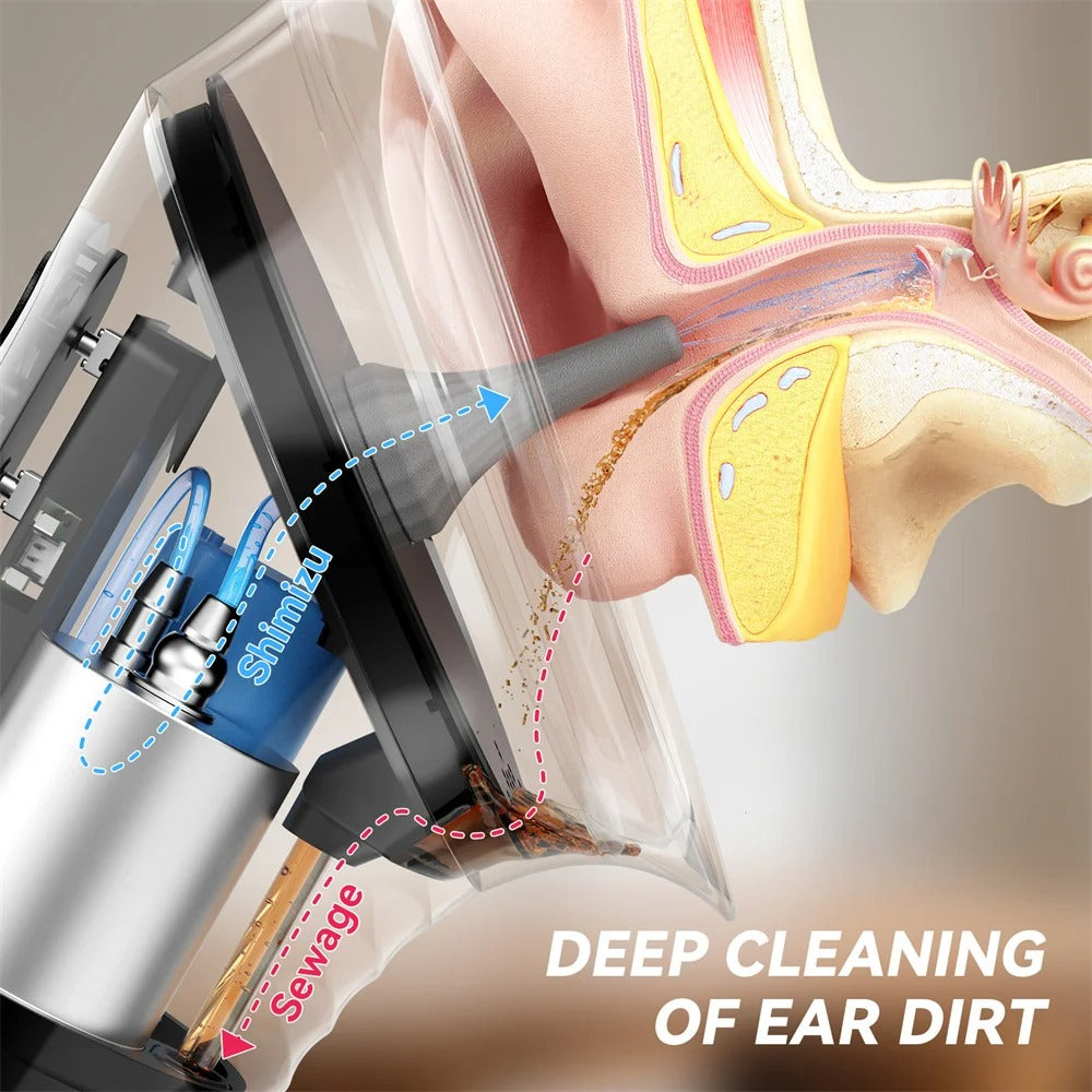 Electric Ear Wax Remover