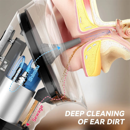 Electric Ear Wax Remover